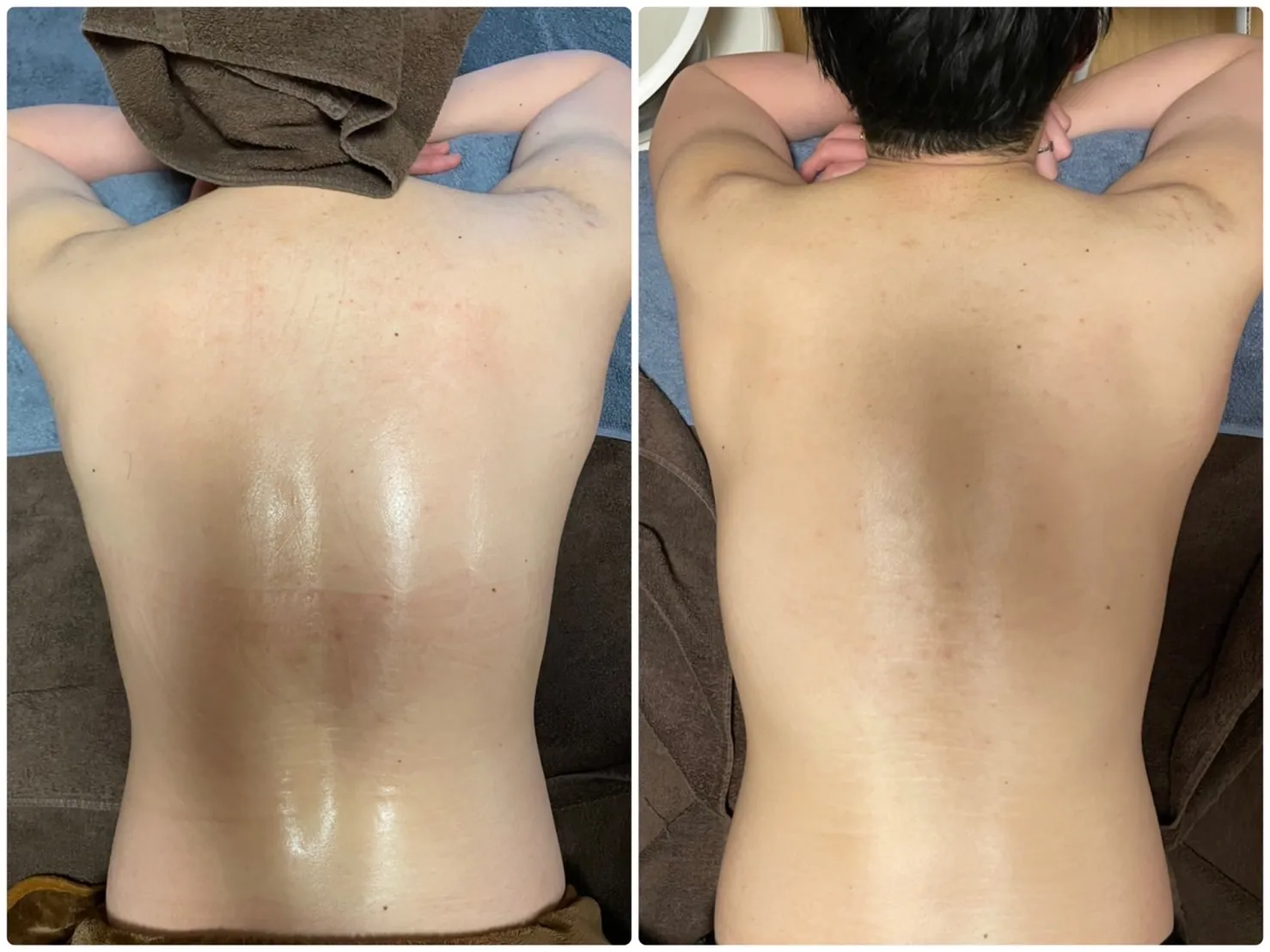 ハーブピーリング一度の変化