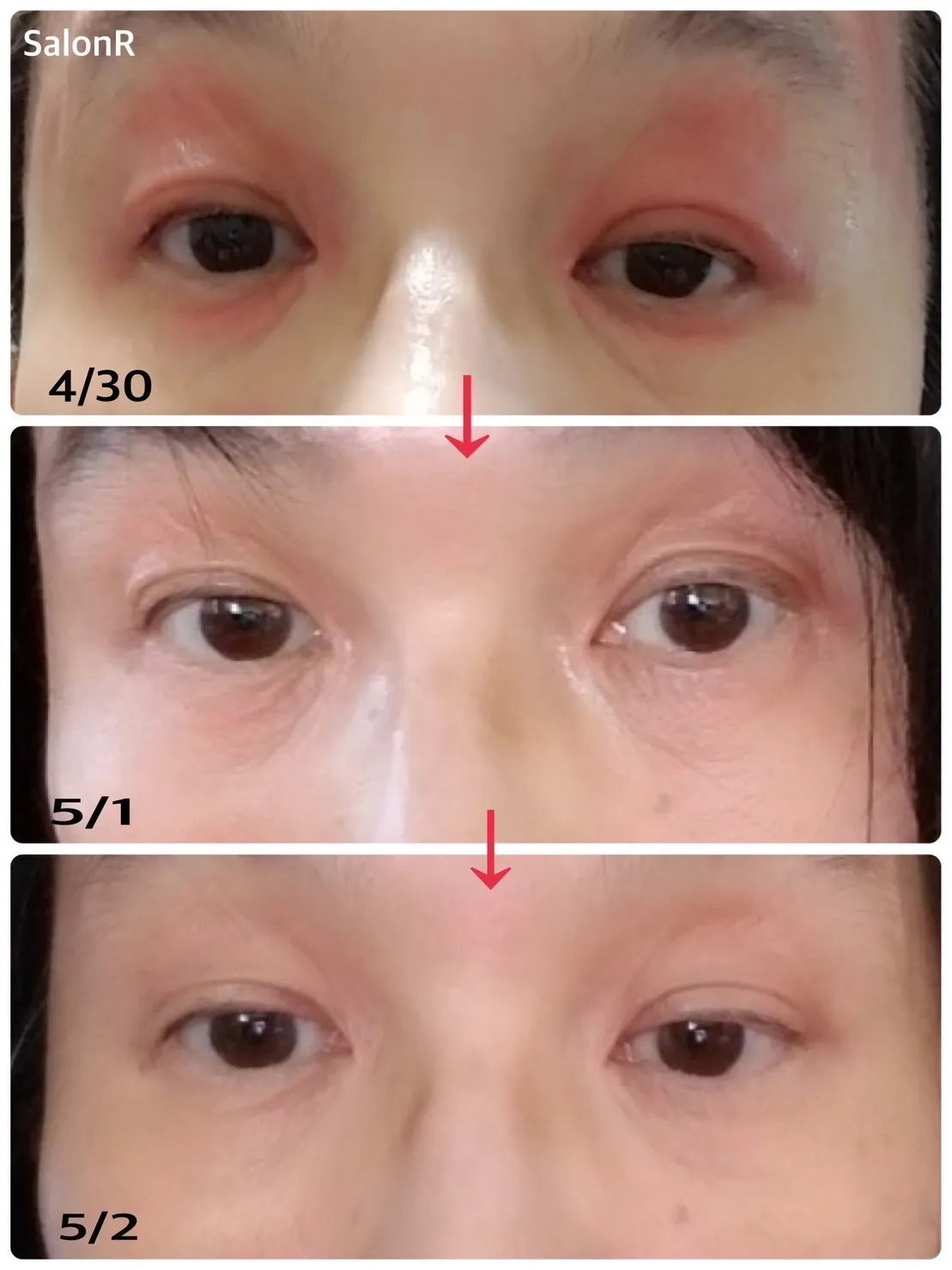 NMNパウダーの使用後の変化