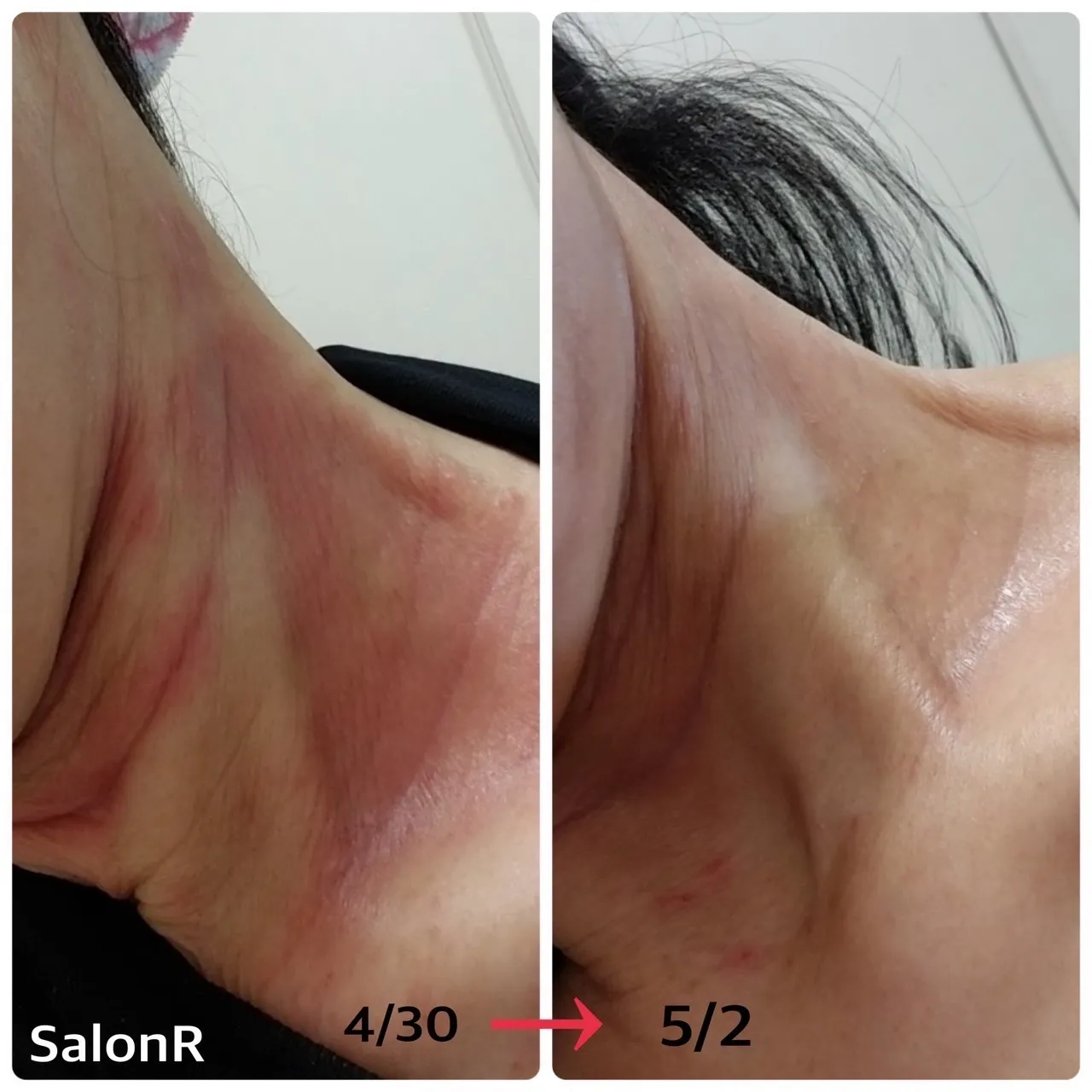 NMNパウダーの使用後の変化