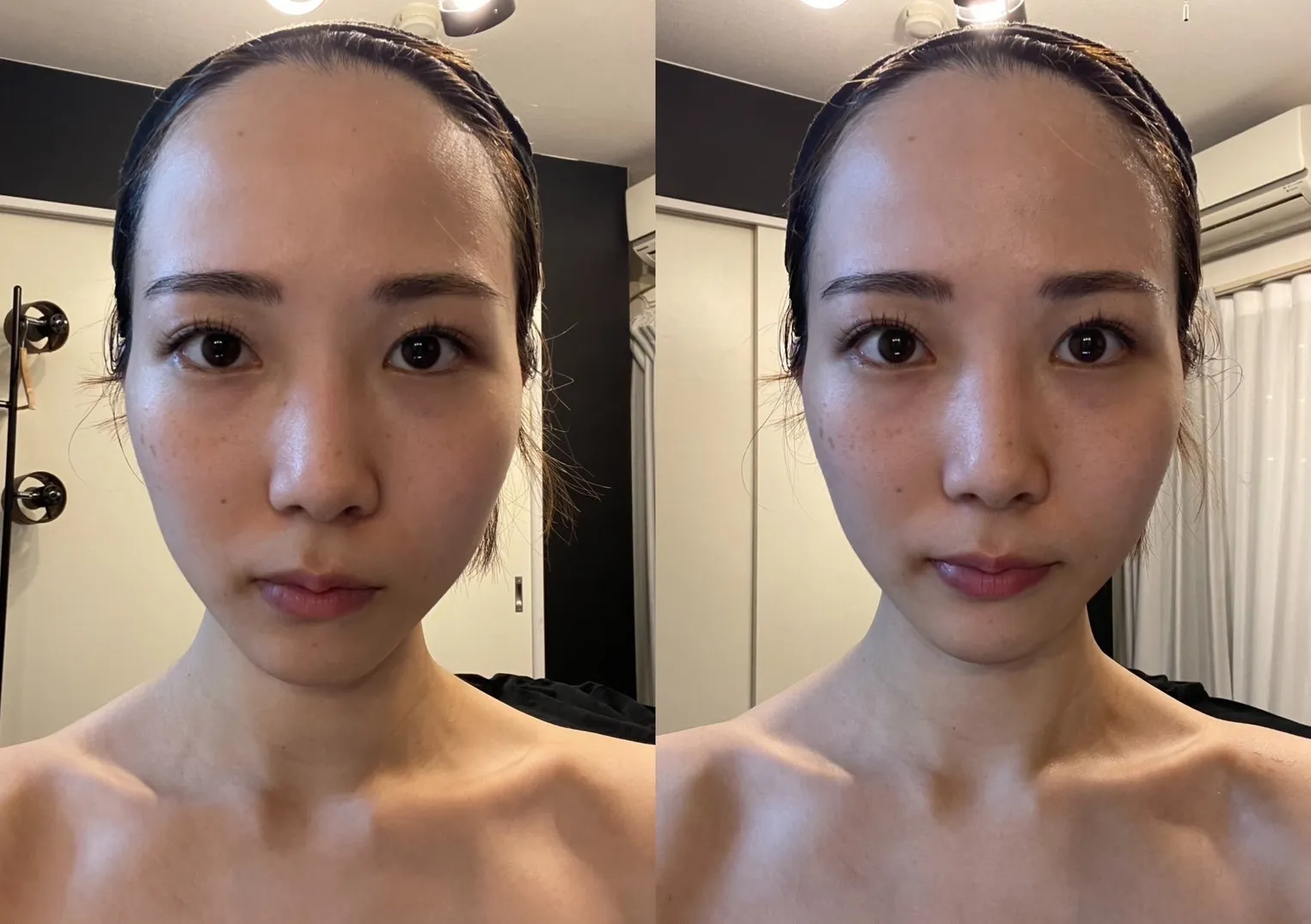 延髄スプレーガン使用後の変化