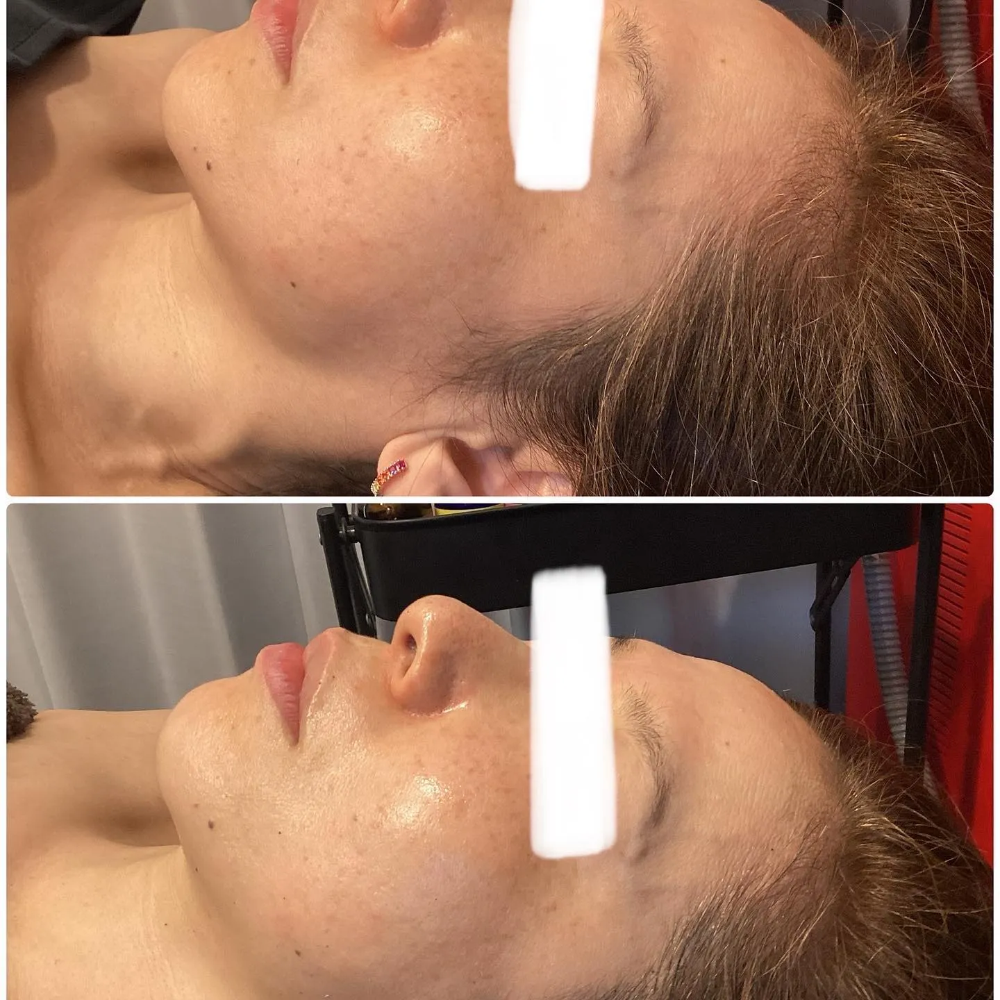 集客に苦戦中の方必見！エステ集客のコツは？