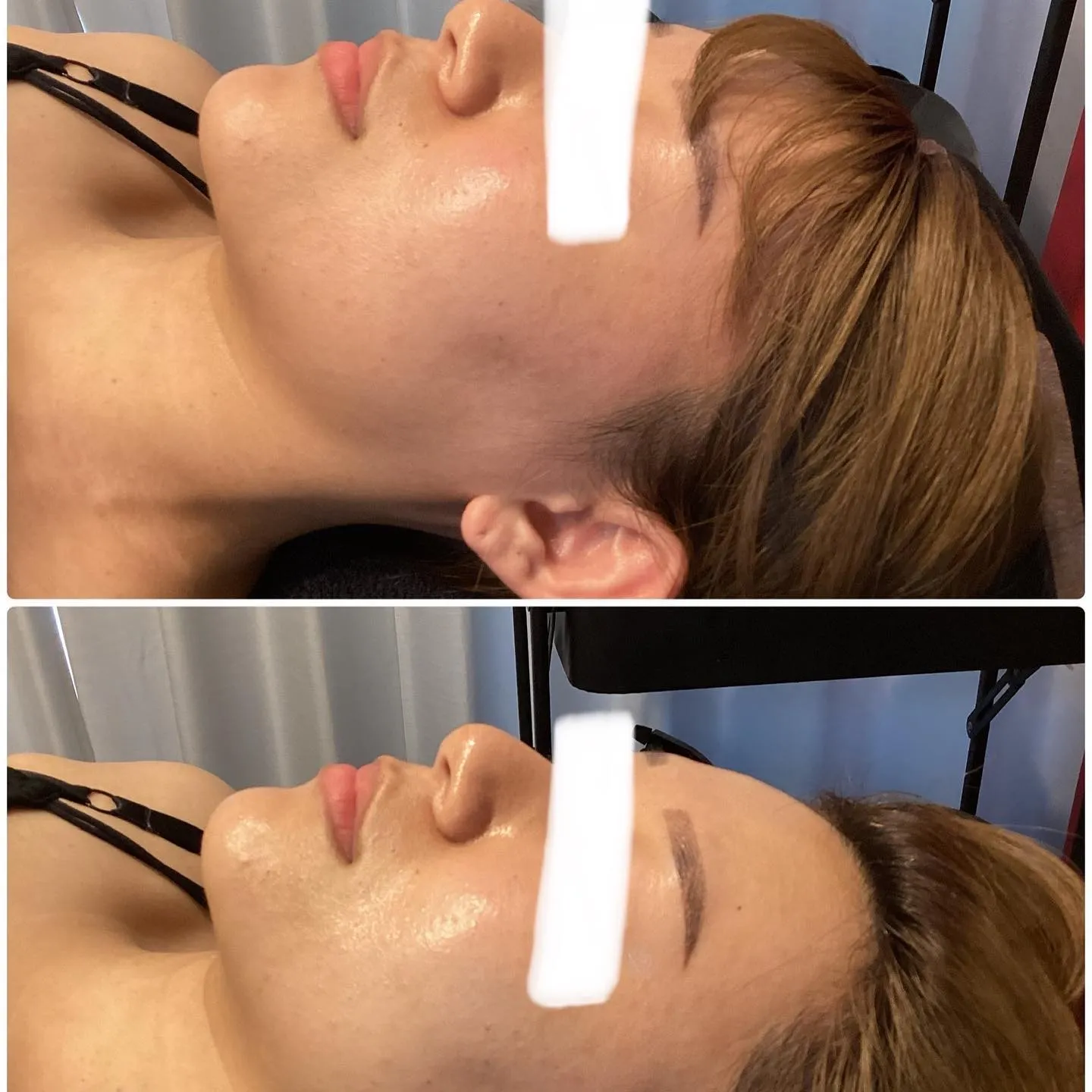 集客に苦戦中の方必見！エステ集客のコツは？