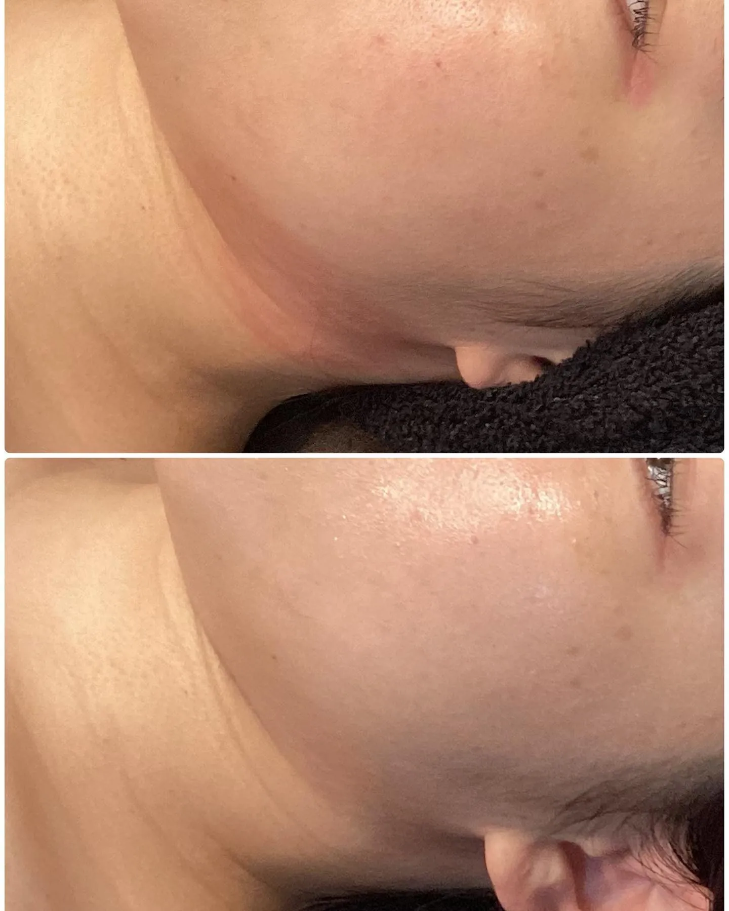 REVI陶肌トリートメントの効果が凄い！（エステ商材）