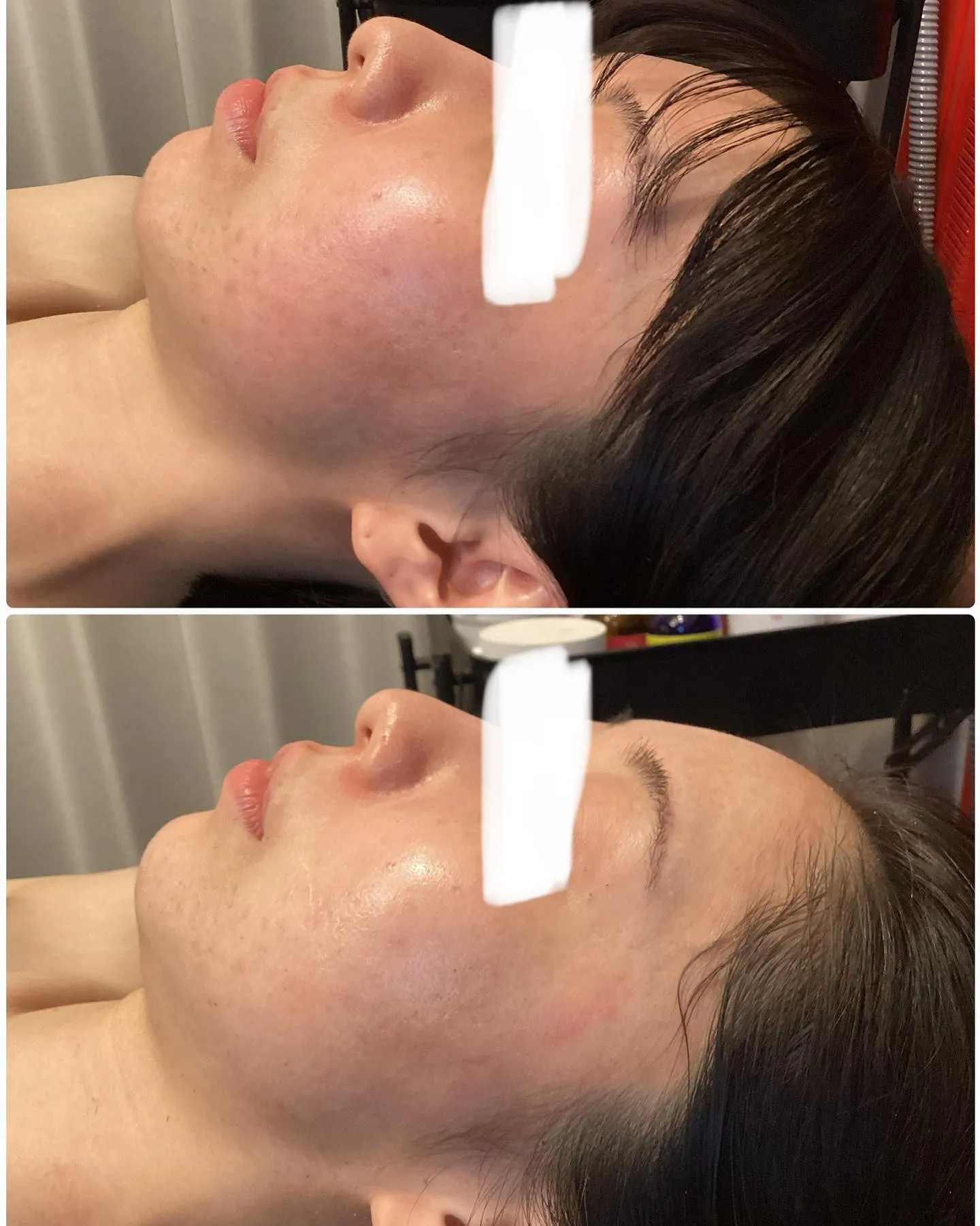 REVIハーブピーリングの商材を導入するには？