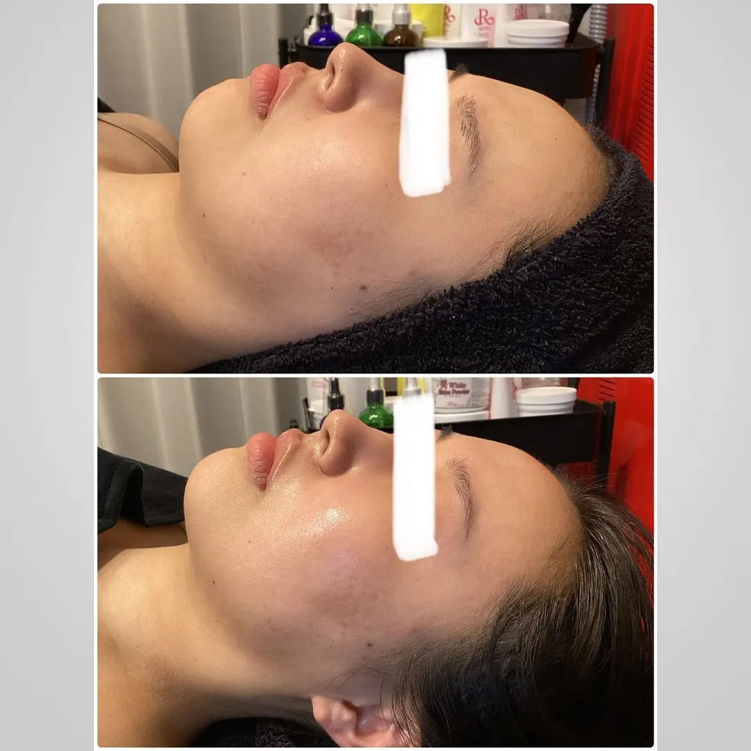 東京でエステ開業するならREVIで！独立が可能です！