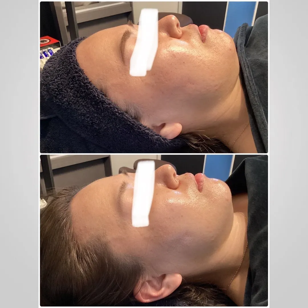 東京でエステ開業するならREVIで！独立が可能です！