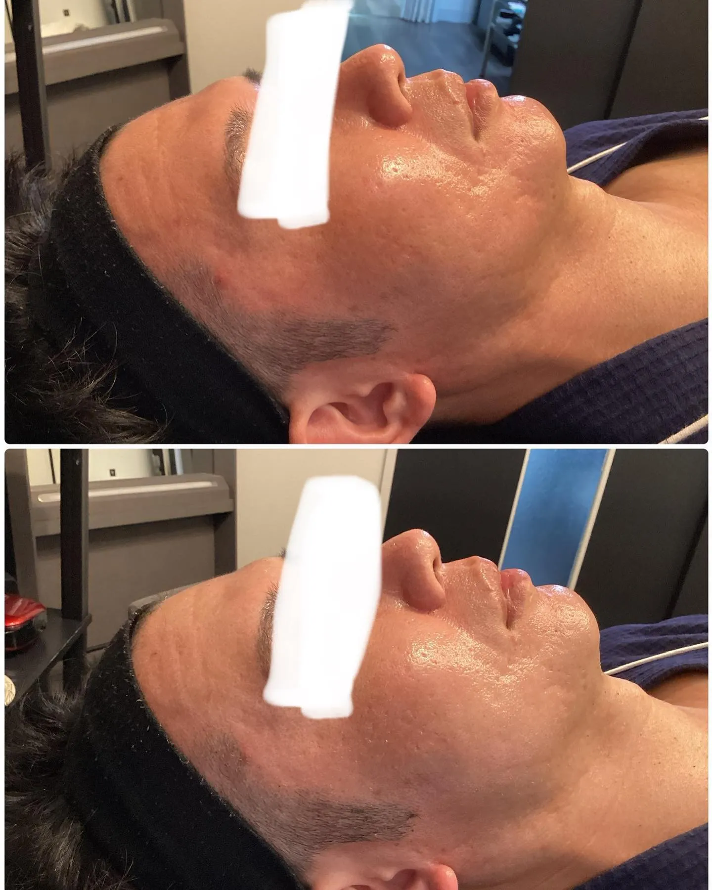 REVI陶肌トリートメントはメンズにも大人気！